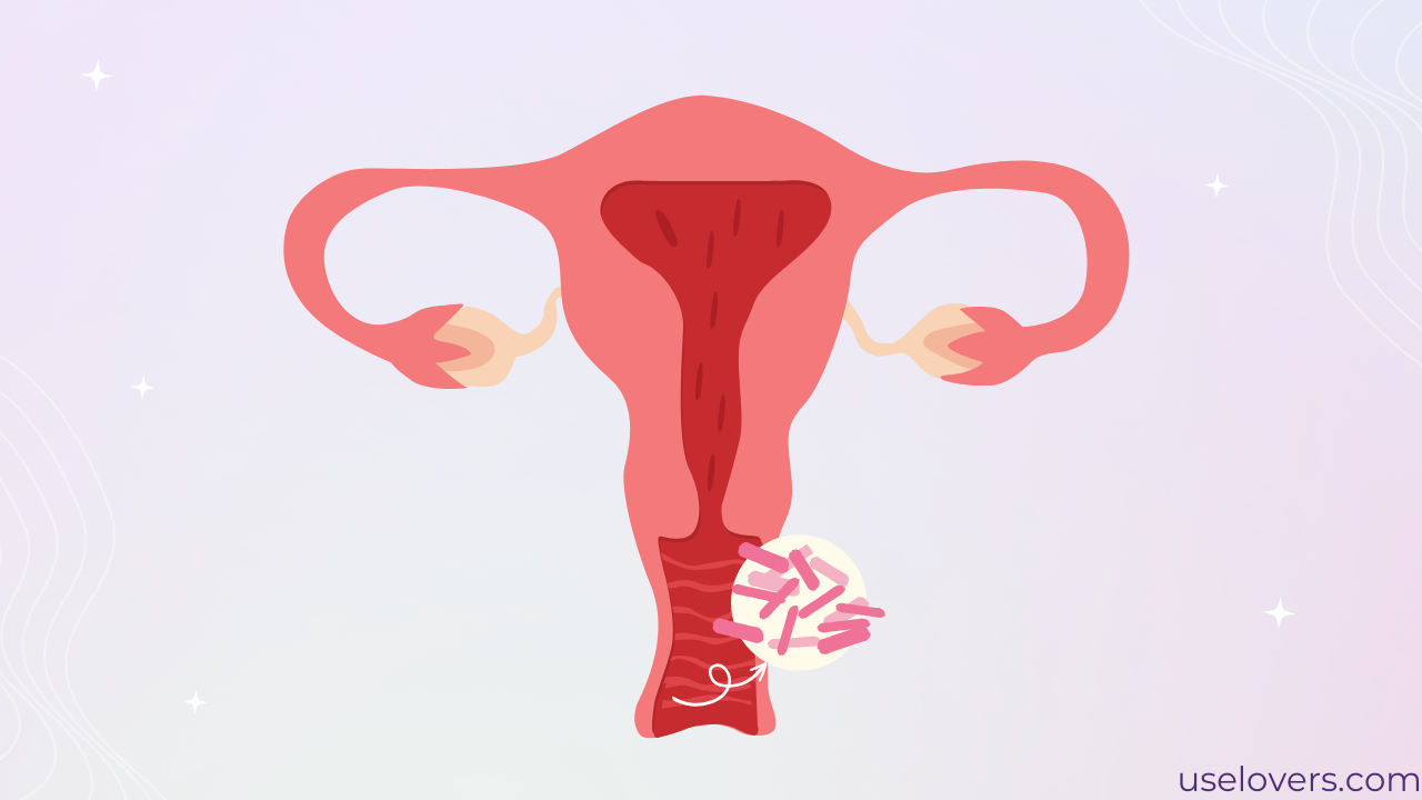 Canal da vagina com útero