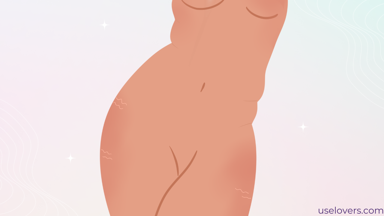 Na imagem temos uma silhueta feminina com gordurinhas e estrias